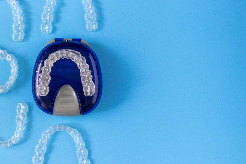 Facts about Invisalign® | Harmony Dental Arts